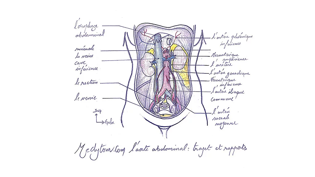 L'aorte abdominale
